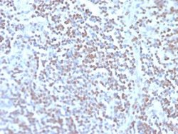 Cyclin D1 Antibody (rCCND1/4752) - Azide and BSA Free, Novus Biologicals